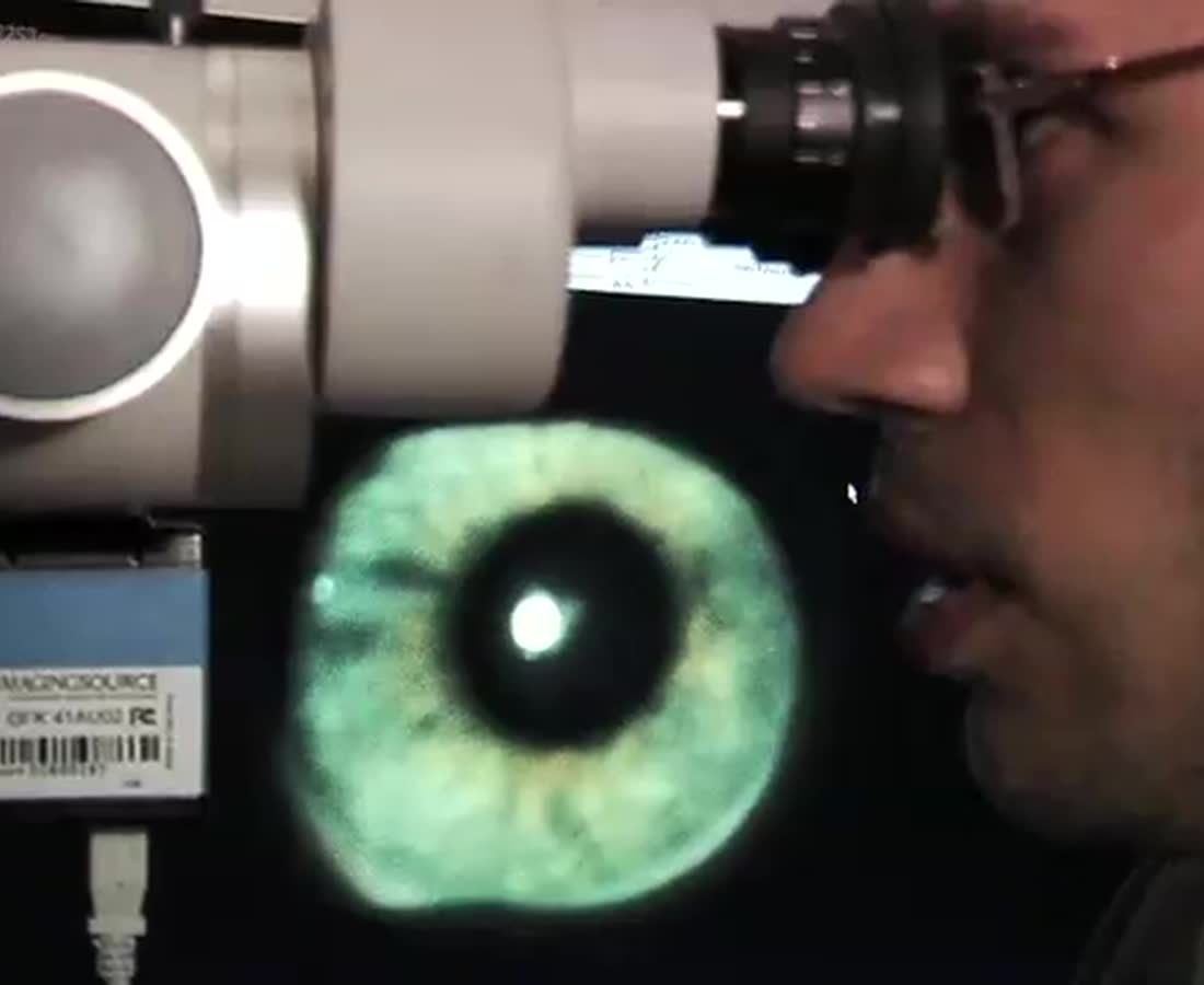 정밀 검안 장면 — 브루클린 아이웨어 광고 Precision eye exam